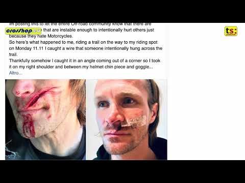 Shocking Incident Taddy Blazusiak Narrowly Escapes Deadly Trap on Trail! 1 1731511189 hqdefault