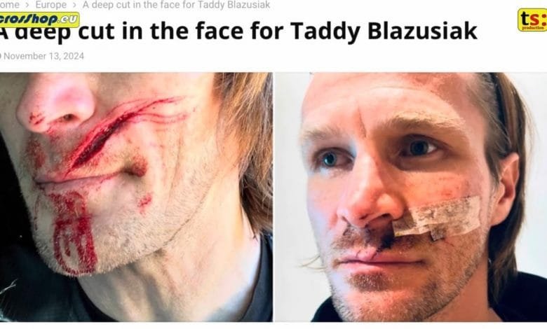 Tentato omicidio su sentiero Taddy Blazusiak sfugge a trappola letale durante il suo allenamento! 1 1731514828 maxresdefault